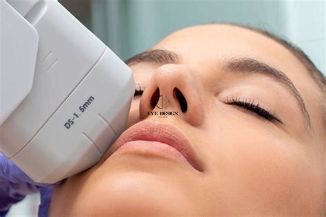 Non Surgical Qualified 4D HIFU Expert .